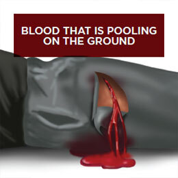 Stop the bleed step 2
