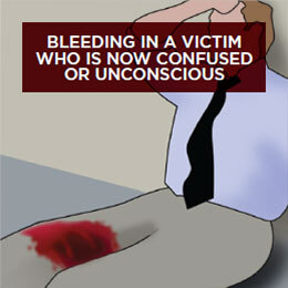 Stop the bleed step 4